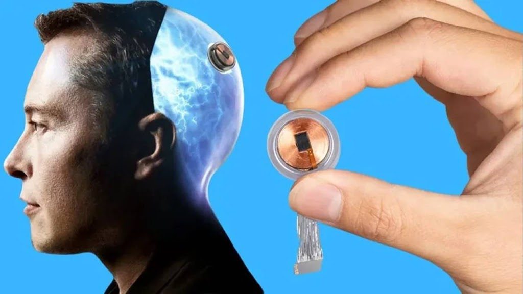 Neuralink: quando Elon Musk pretende implantar chip no cérebro humano?